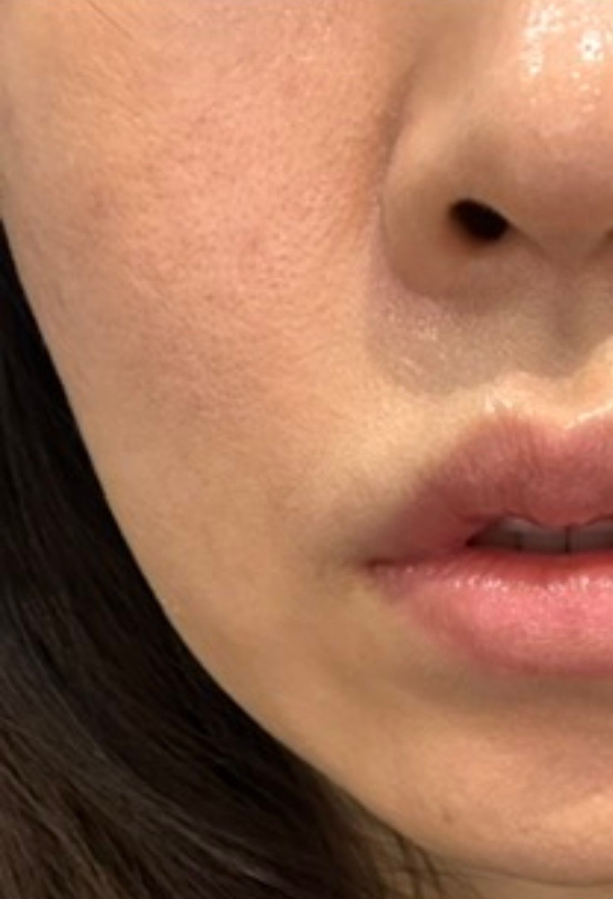 수술후기이미지