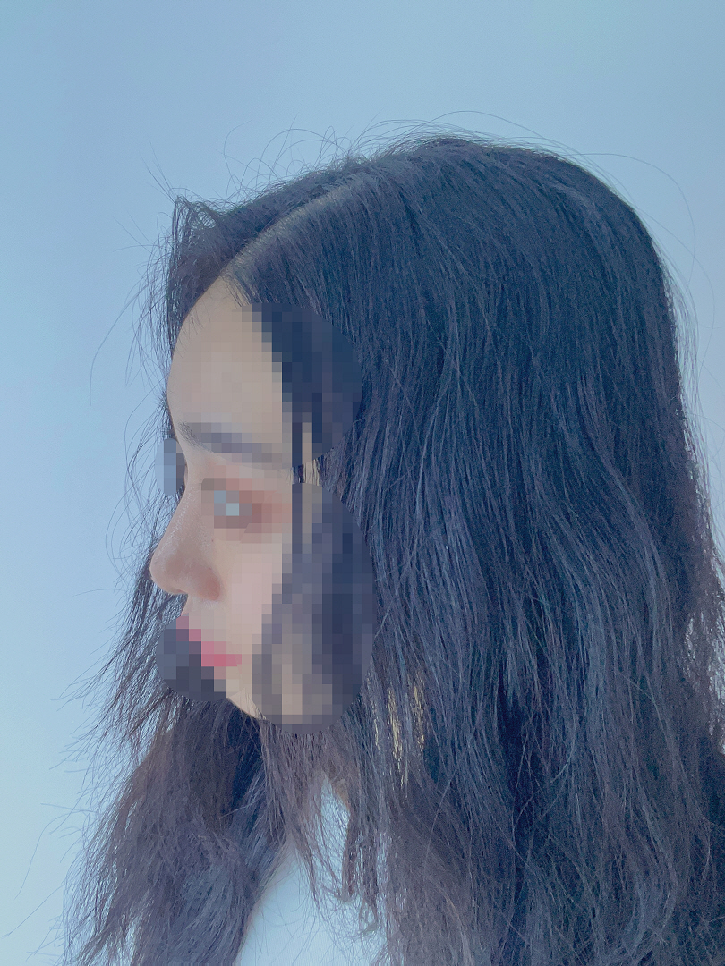 수술후기이미지