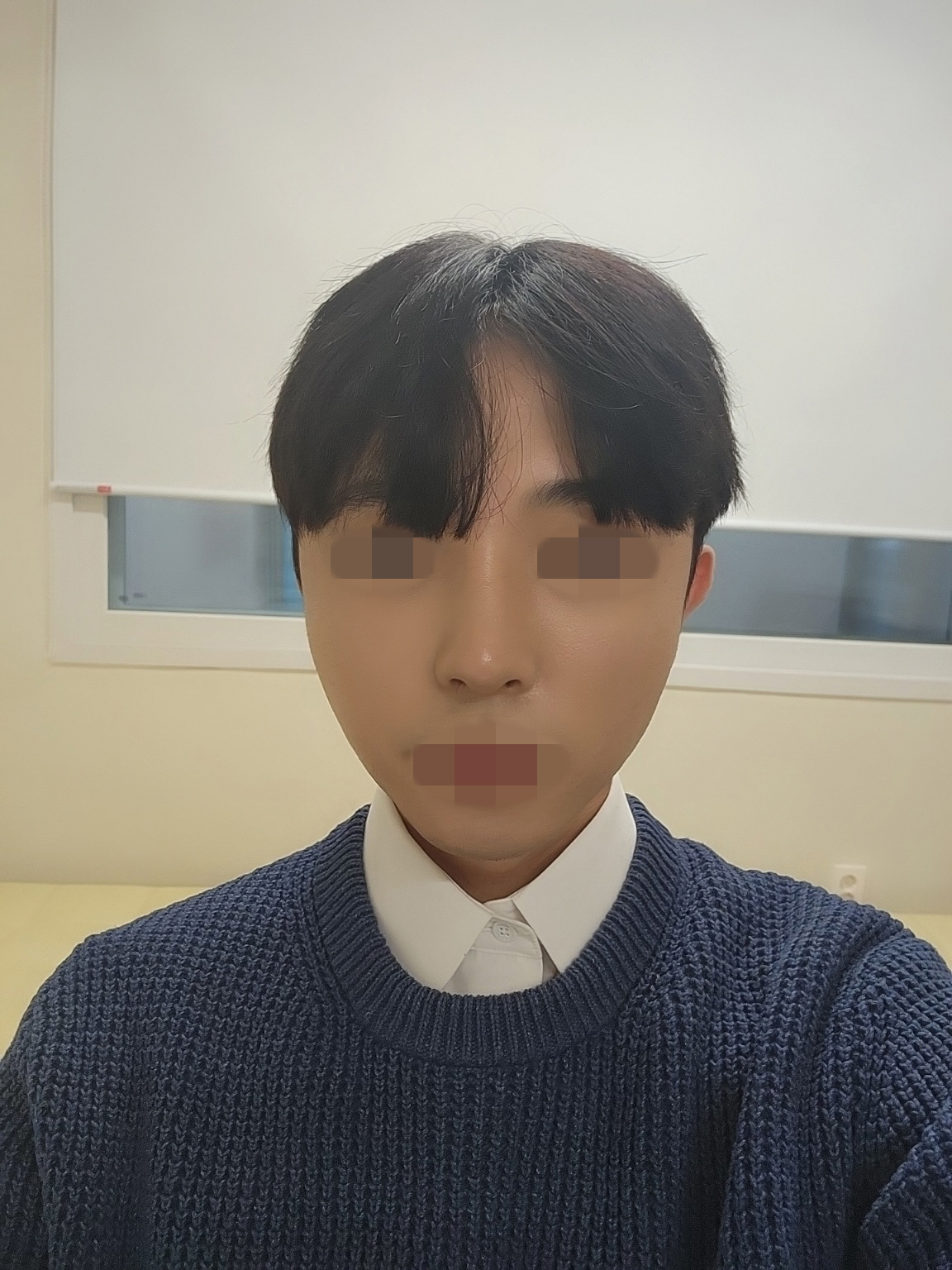 수술후기이미지