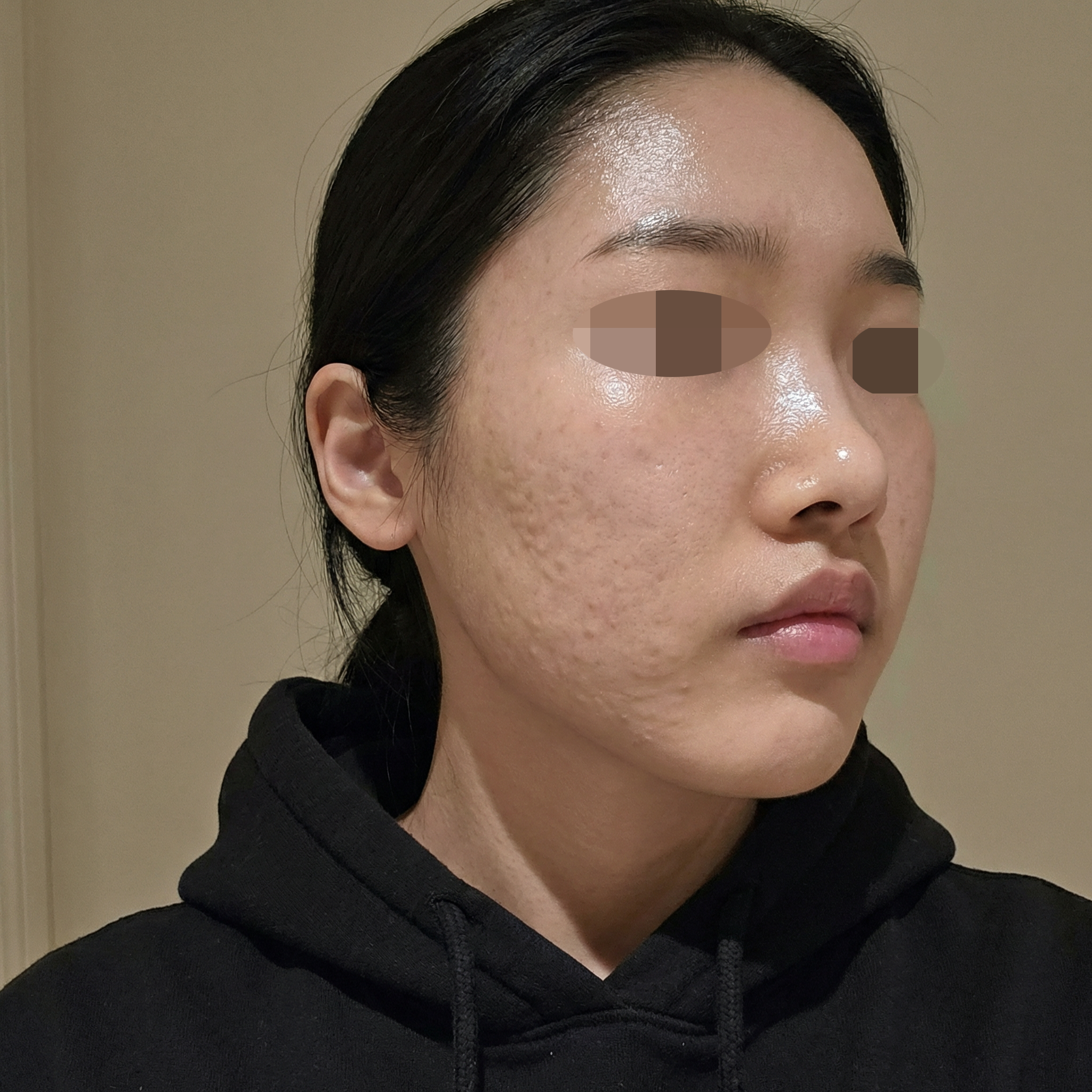 수술후기이미지