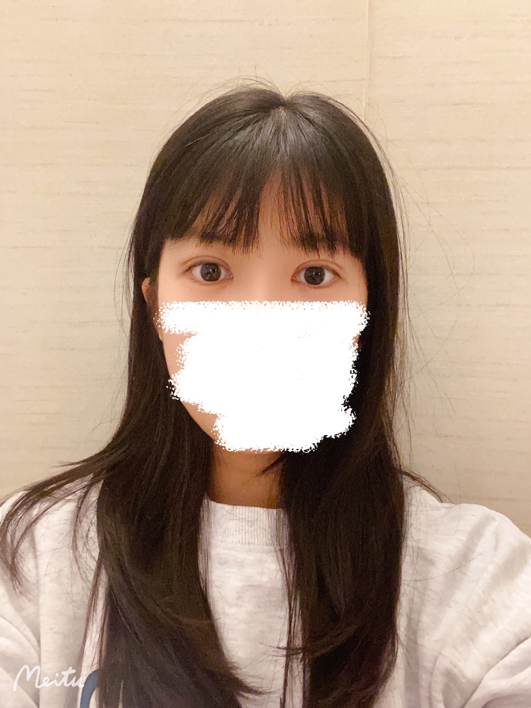 수술후기이미지