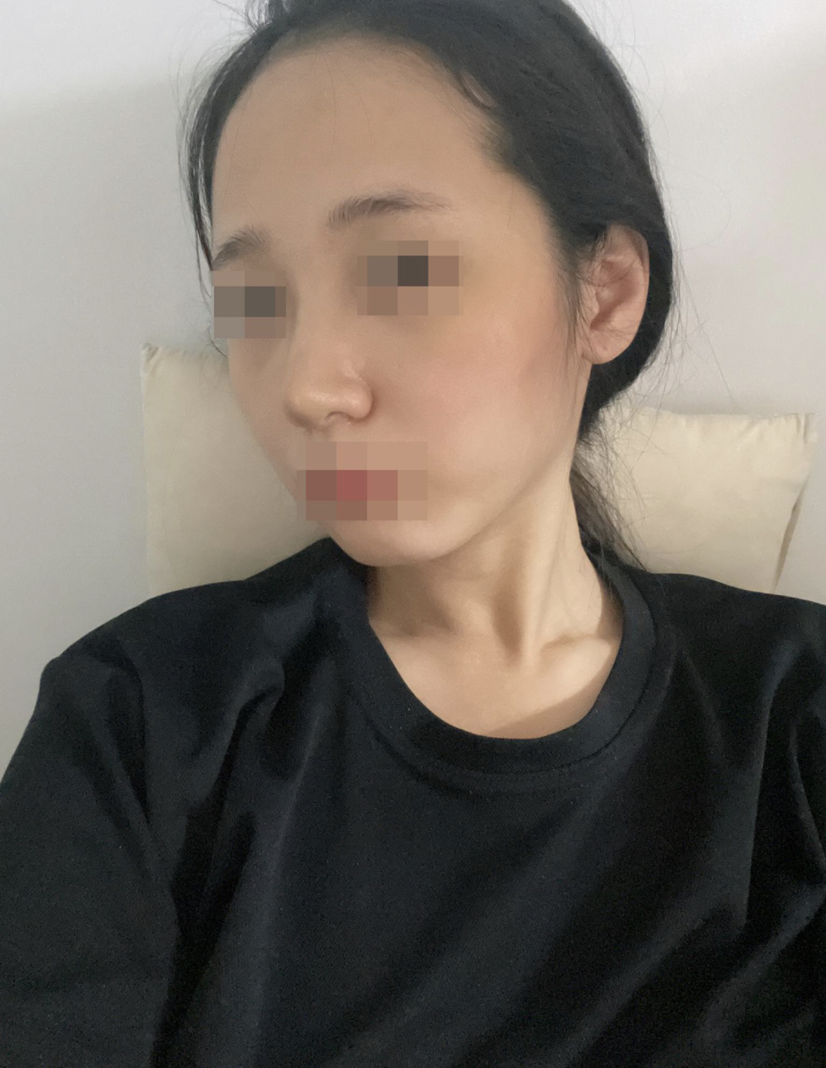 수술후기이미지