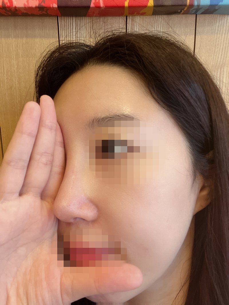 수술후기이미지