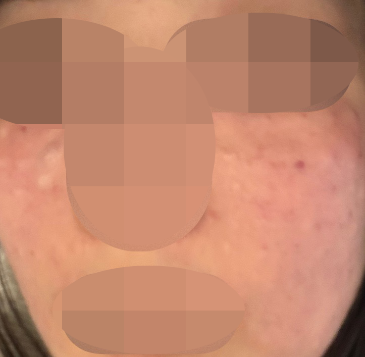 수술후기이미지