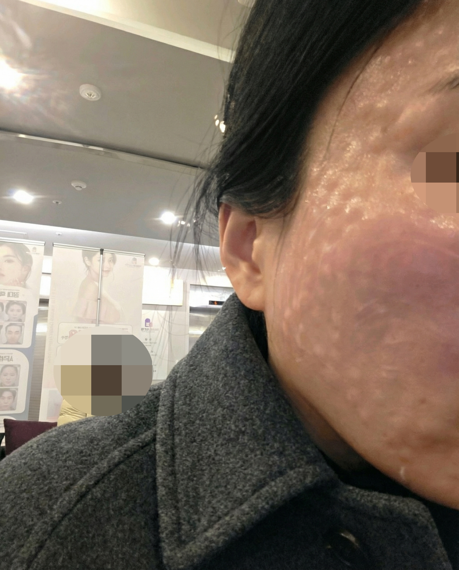 수술후기이미지