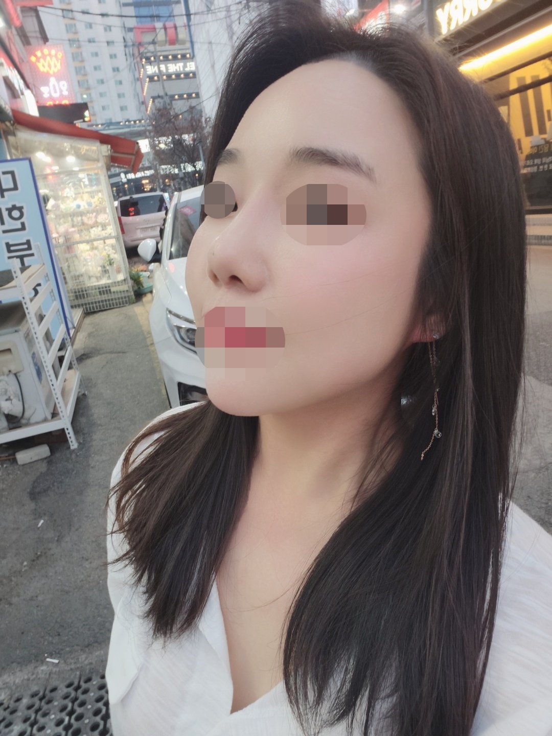 수술후기이미지