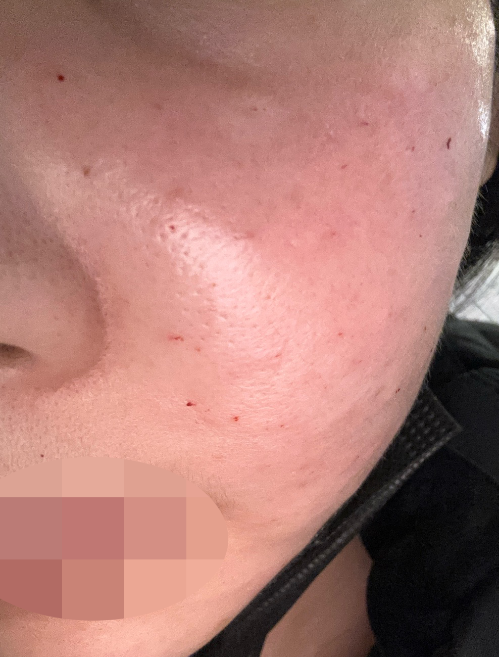 수술후기이미지