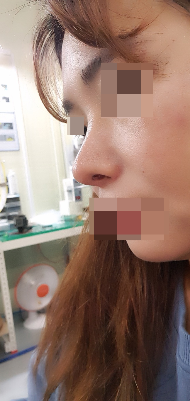 수술후기이미지