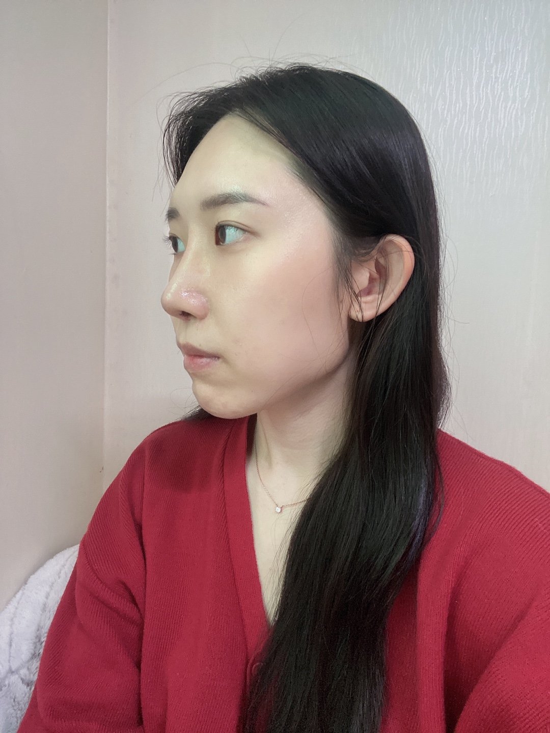 수술후기이미지