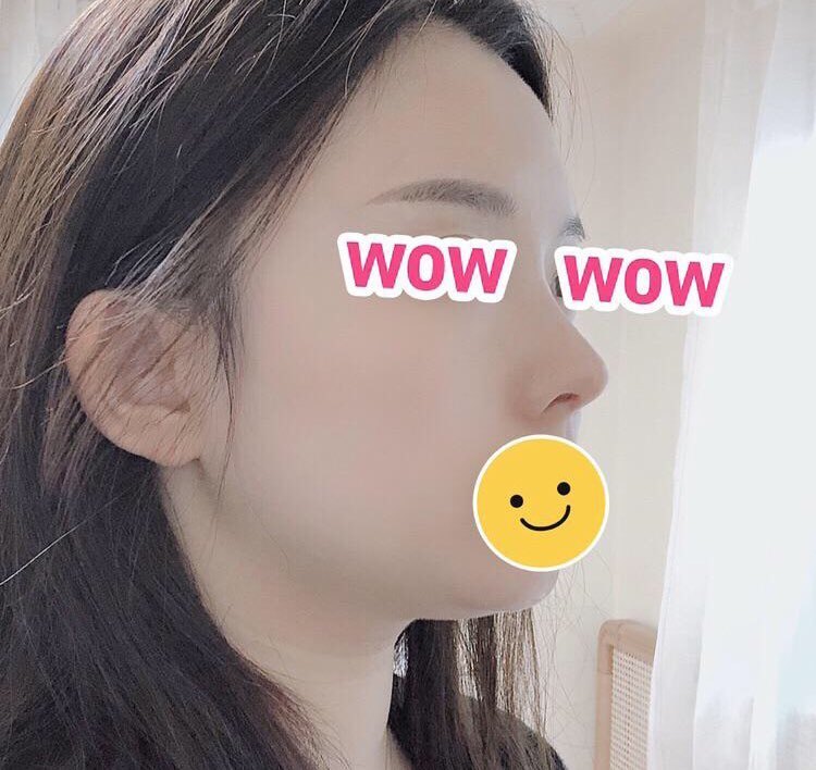 수술후기이미지