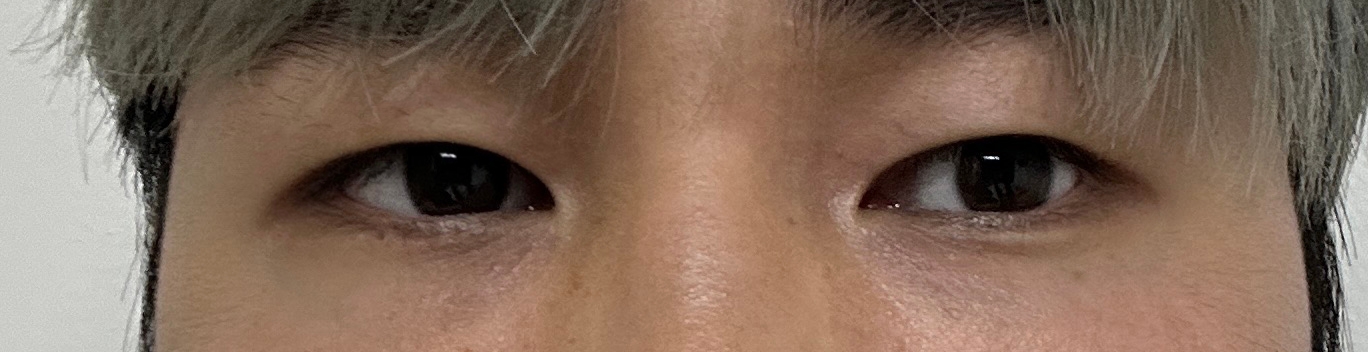 수술후기이미지