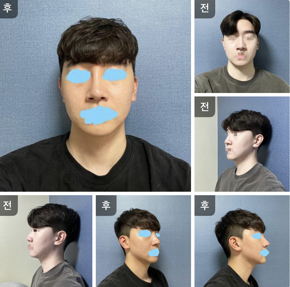 수술후기이미지