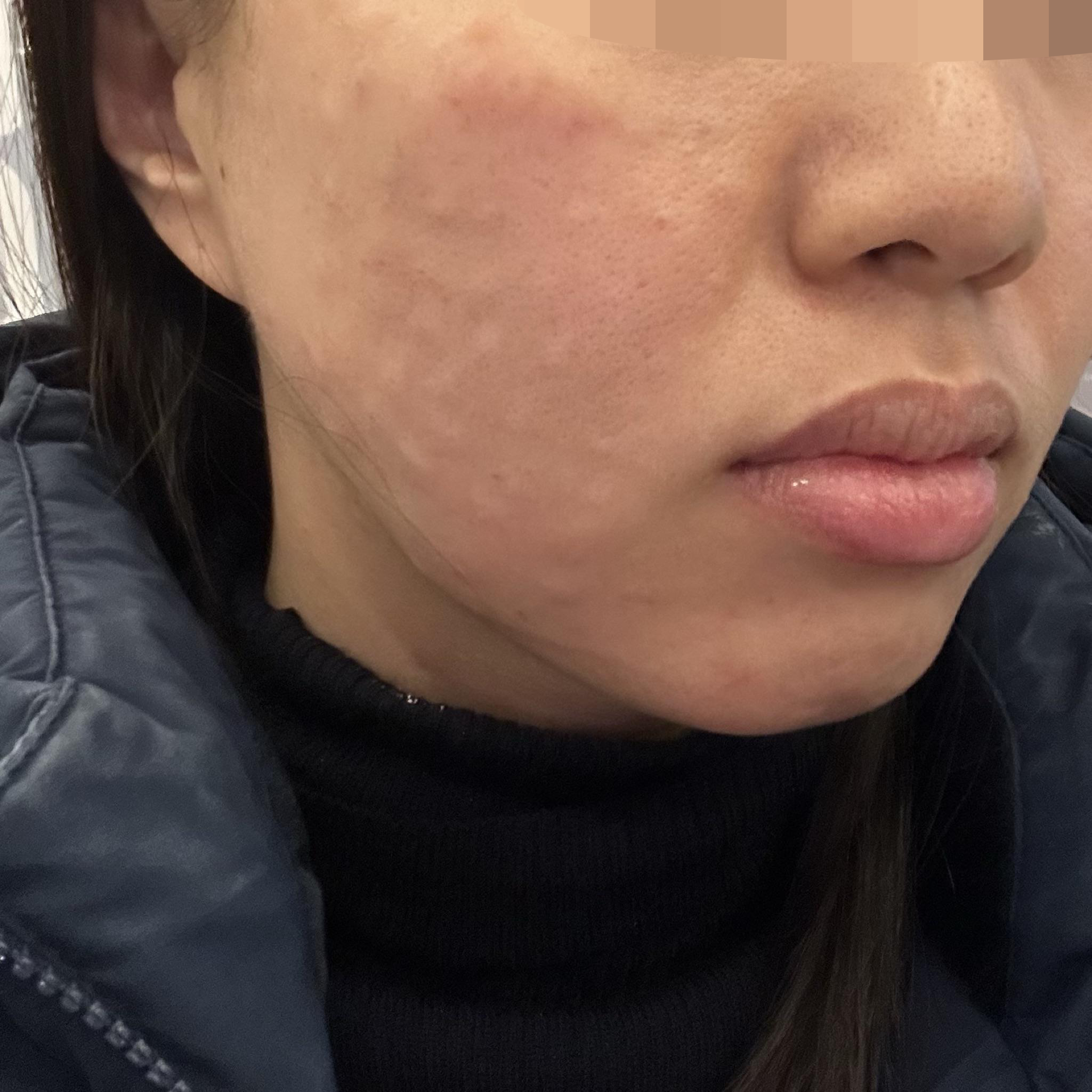 수술후기이미지