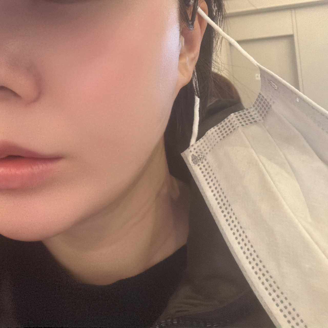 수술후기이미지