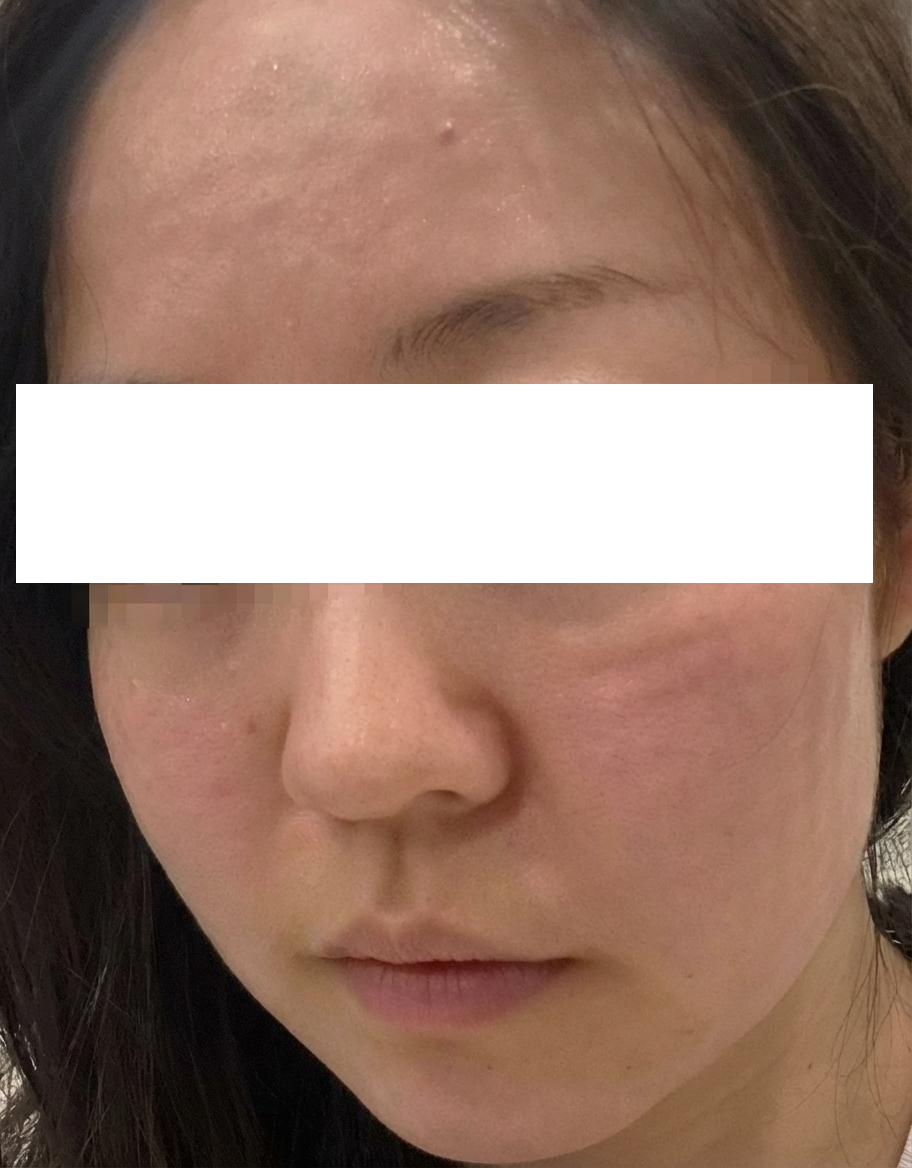 수술후기이미지