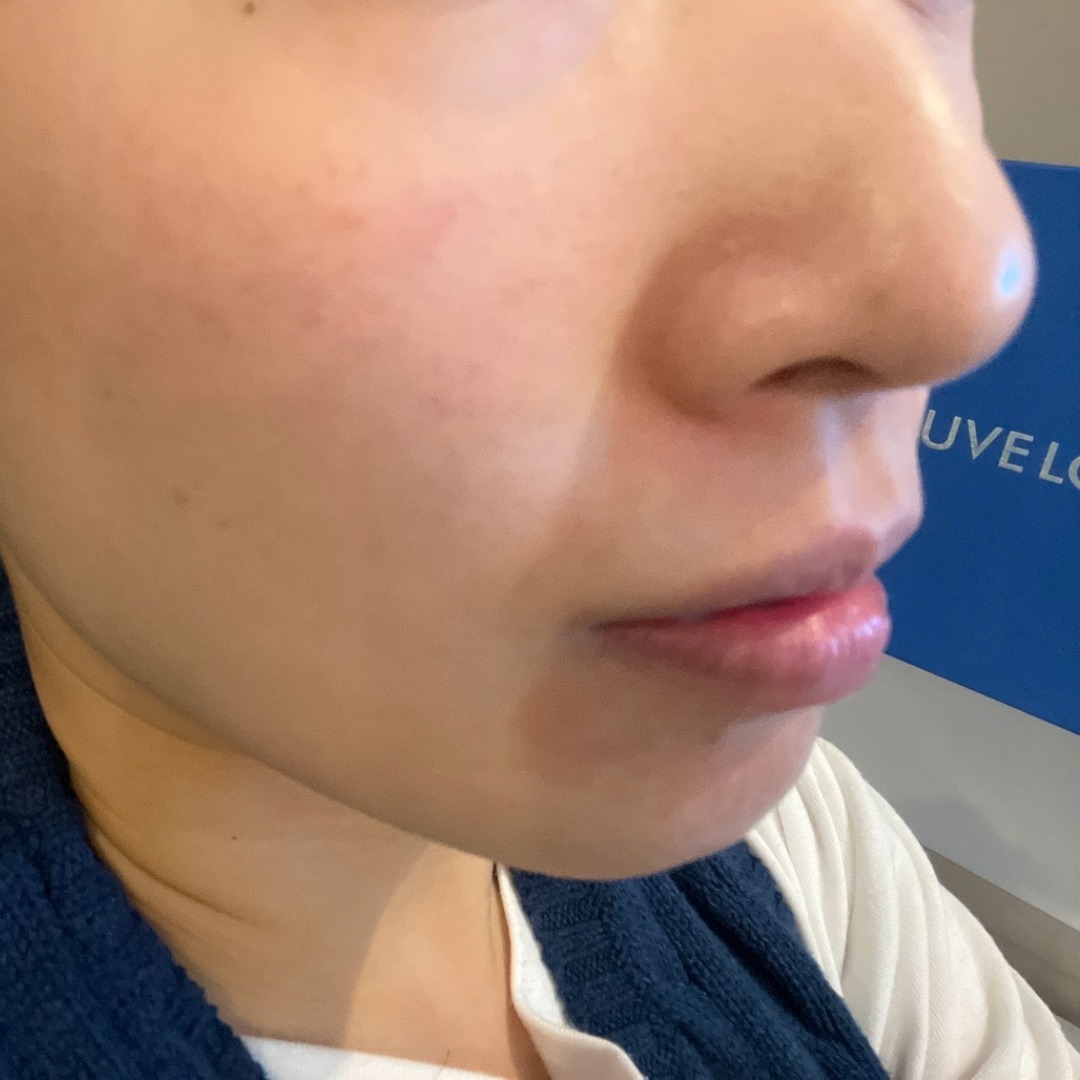 수술후기이미지