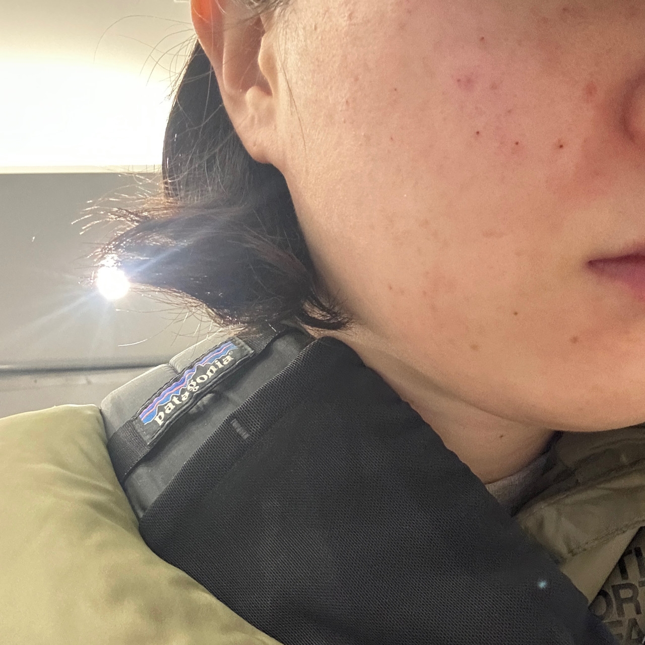 수술후기이미지