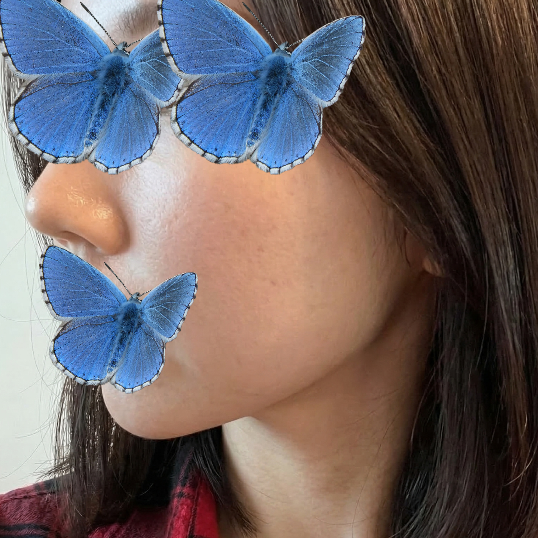 수술후기이미지