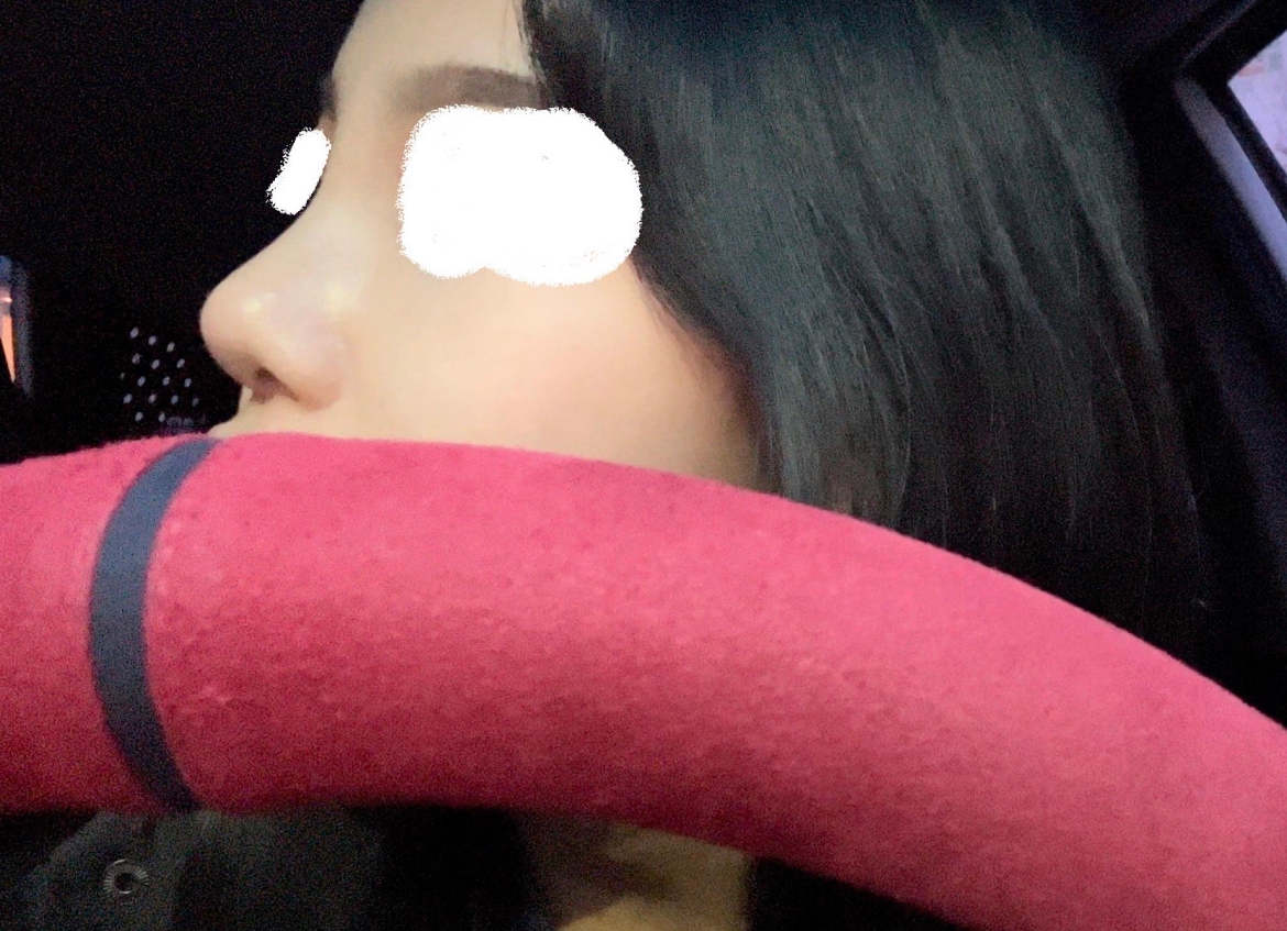 수술후기이미지