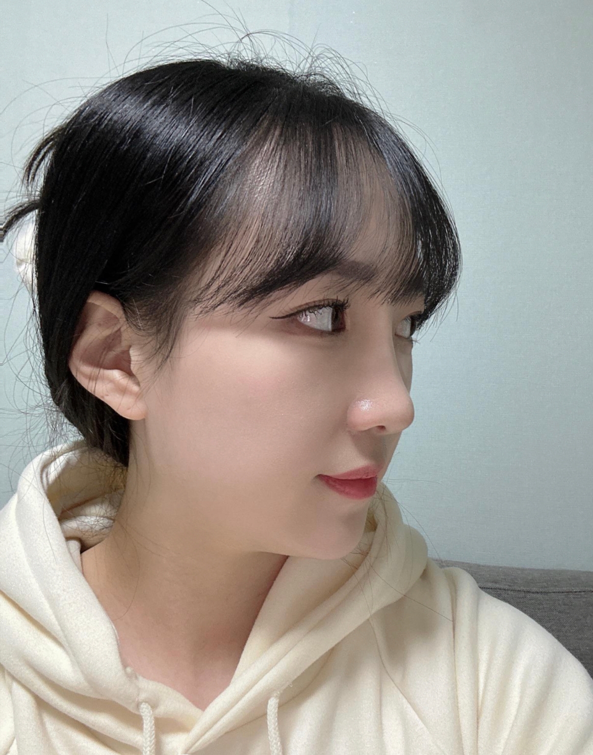 수술후기이미지