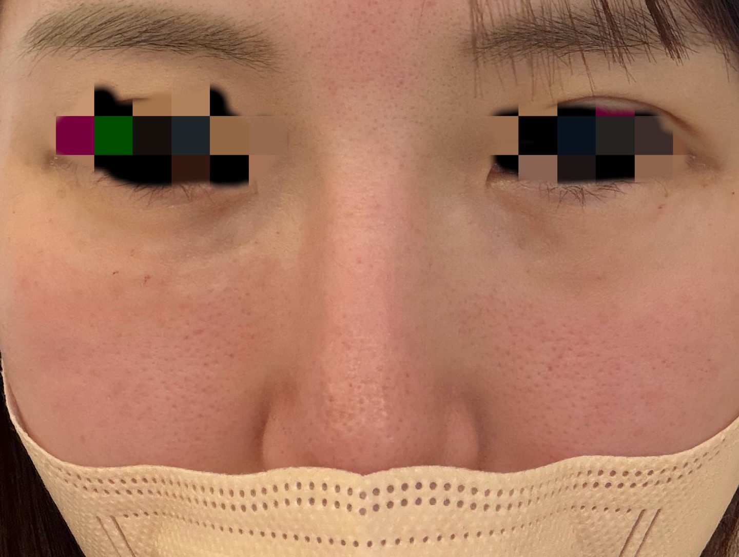 수술후기이미지