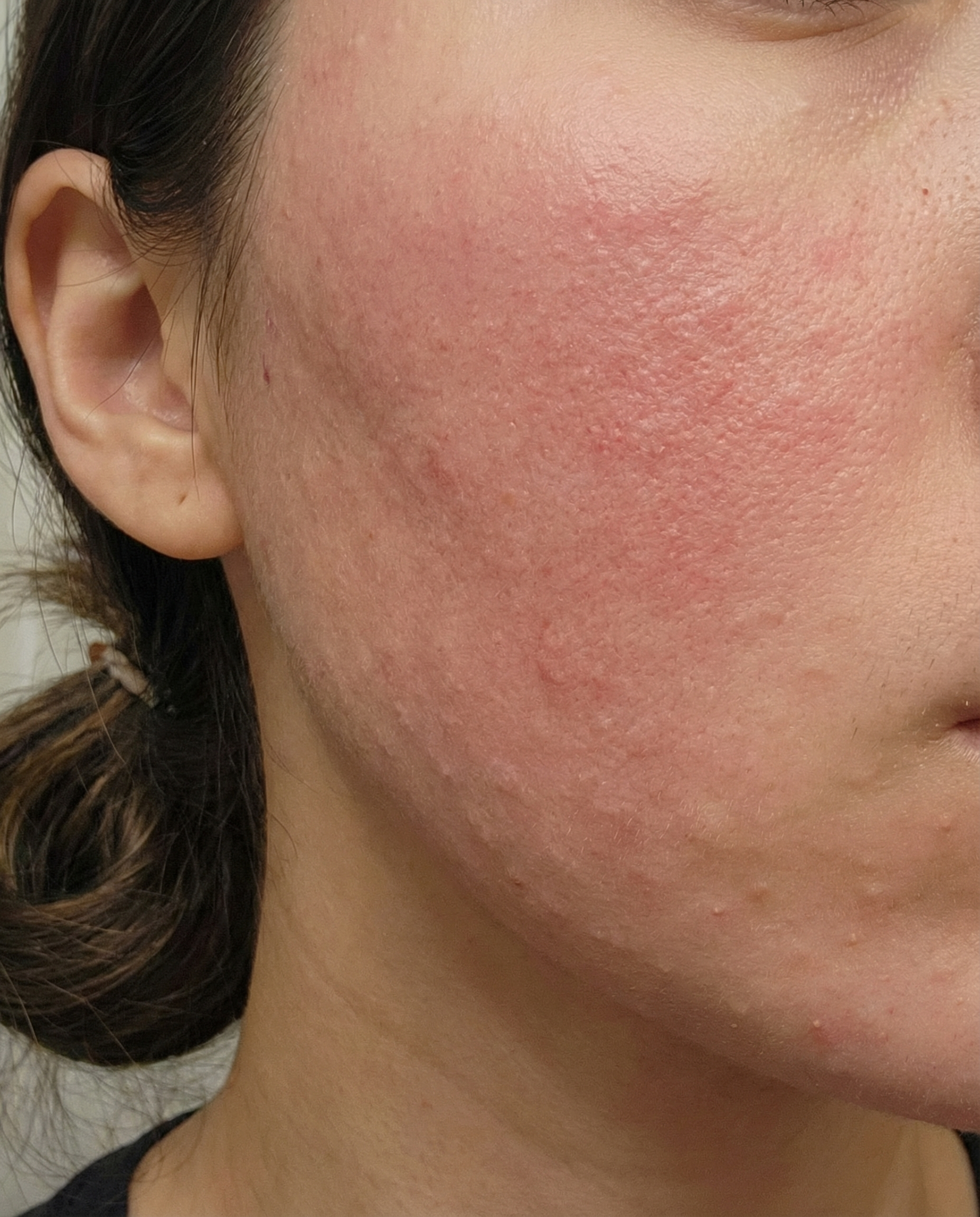 수술후기이미지