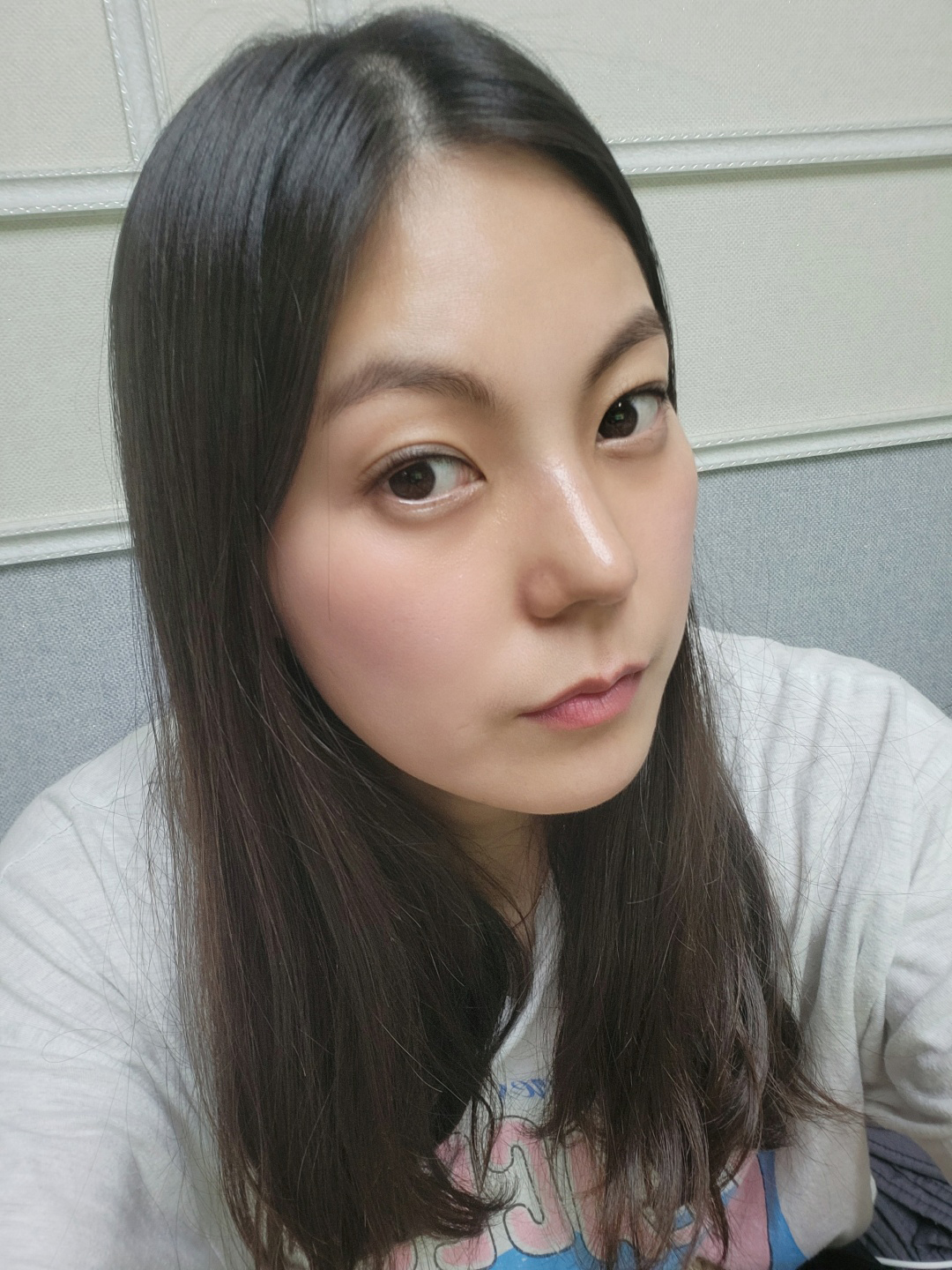 수술후기이미지