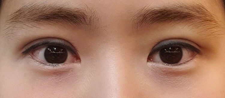 수술후기이미지