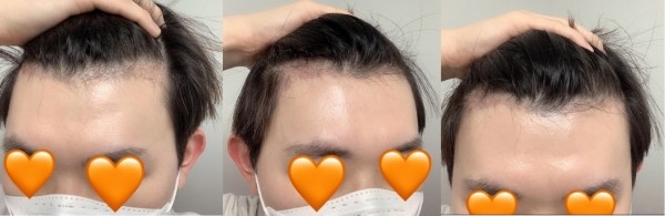 수술후기이미지