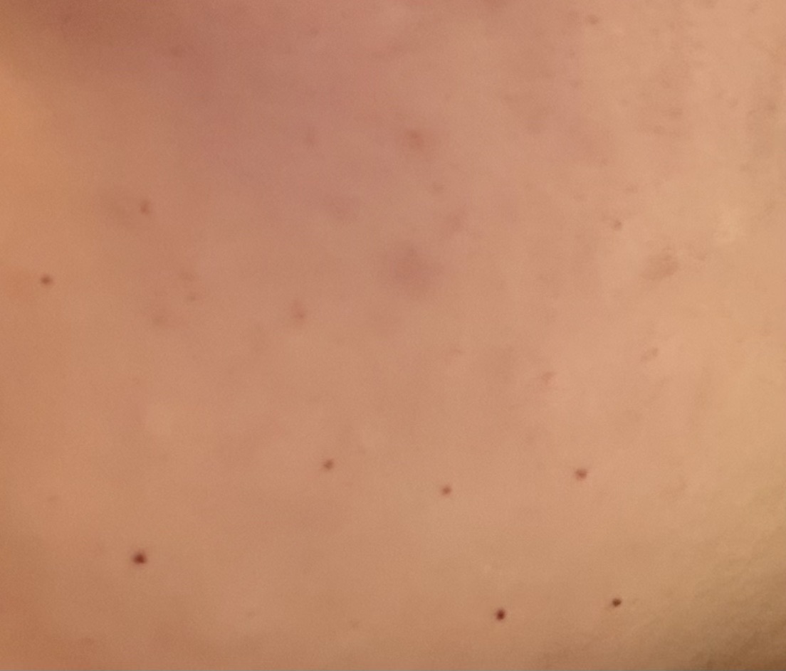 수술후기이미지