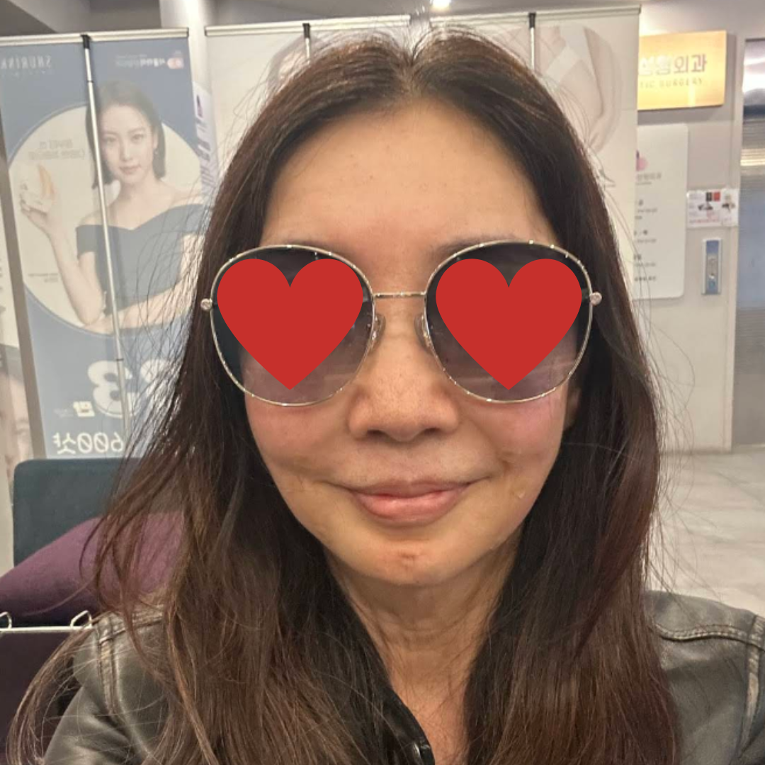 수술후기이미지