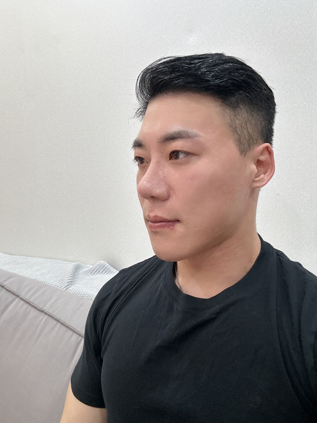 수술후기이미지