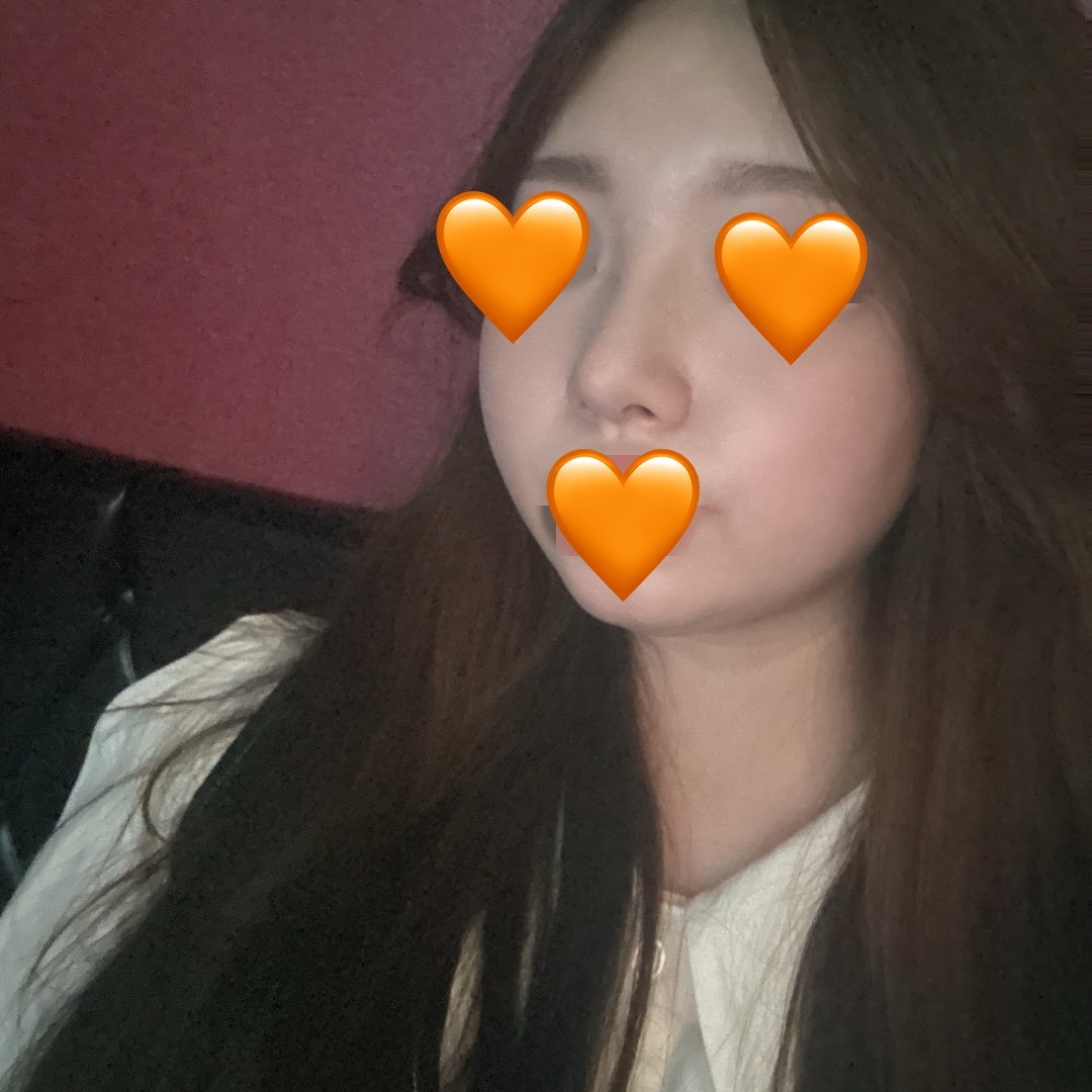 수술후기이미지