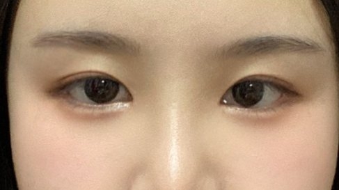 수술후기이미지