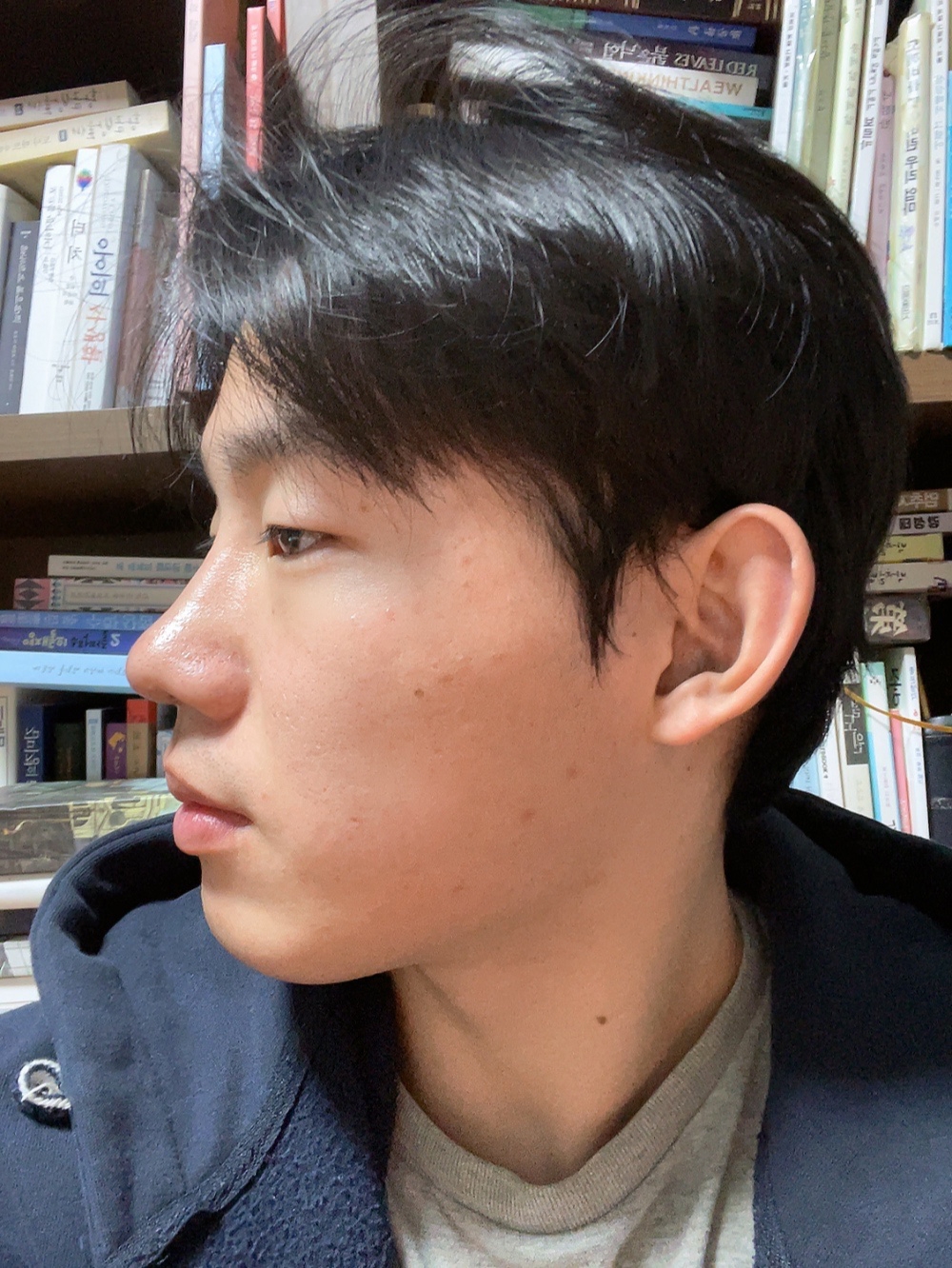 수술후기이미지