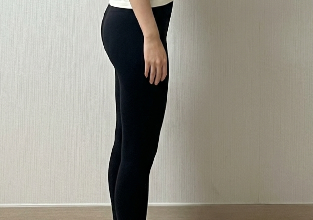 수술후기이미지