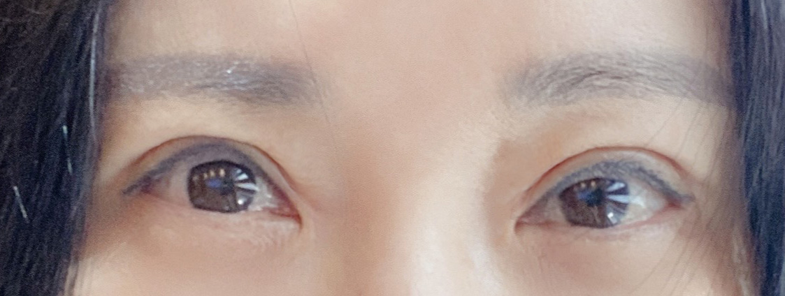 수술후기이미지
