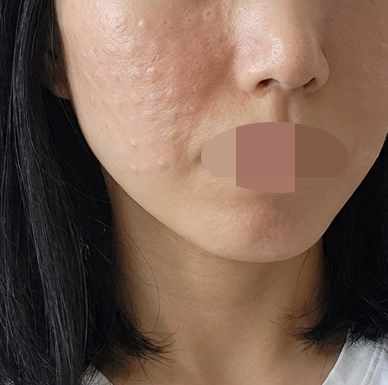 수술후기이미지