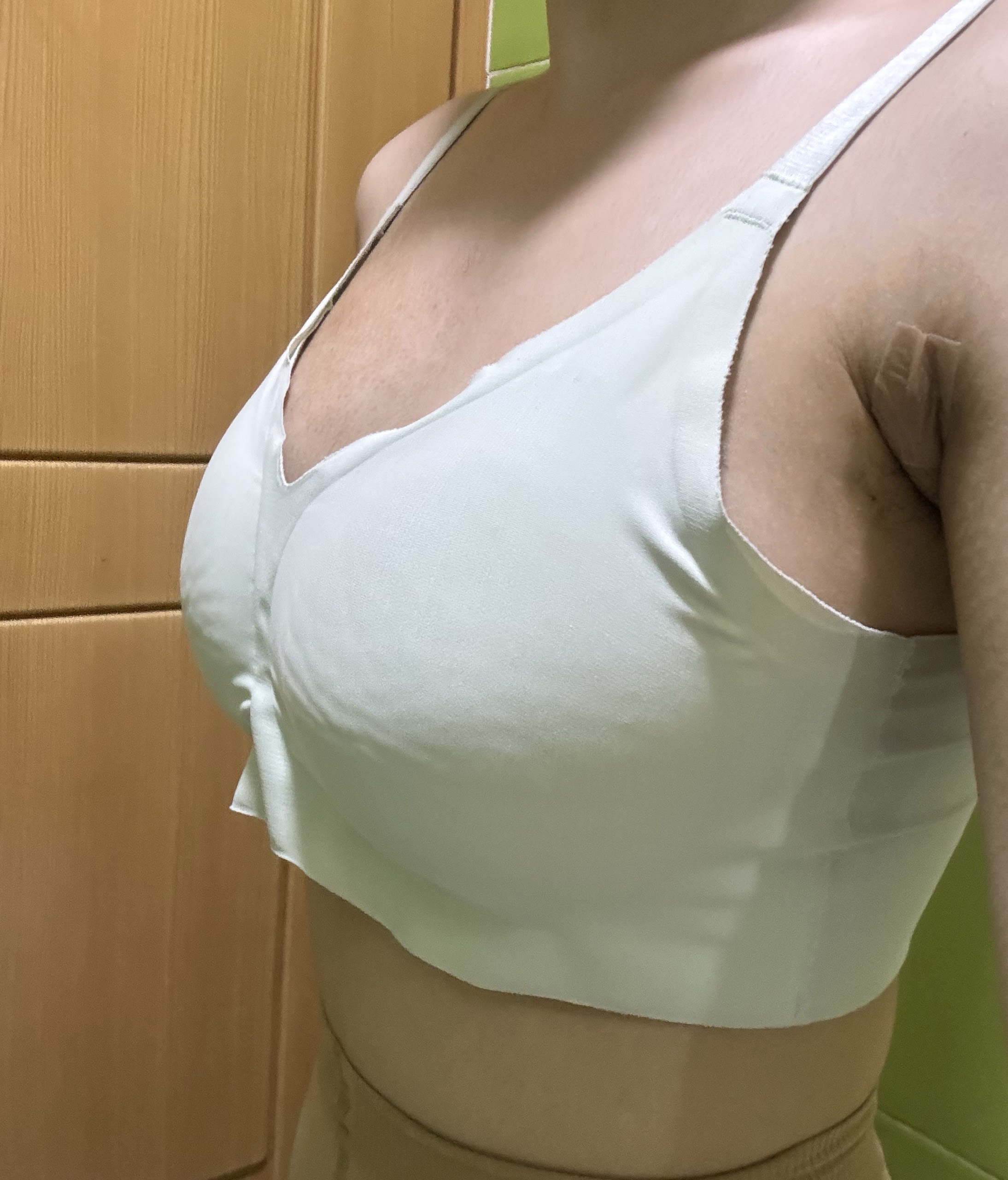 수술후기이미지
