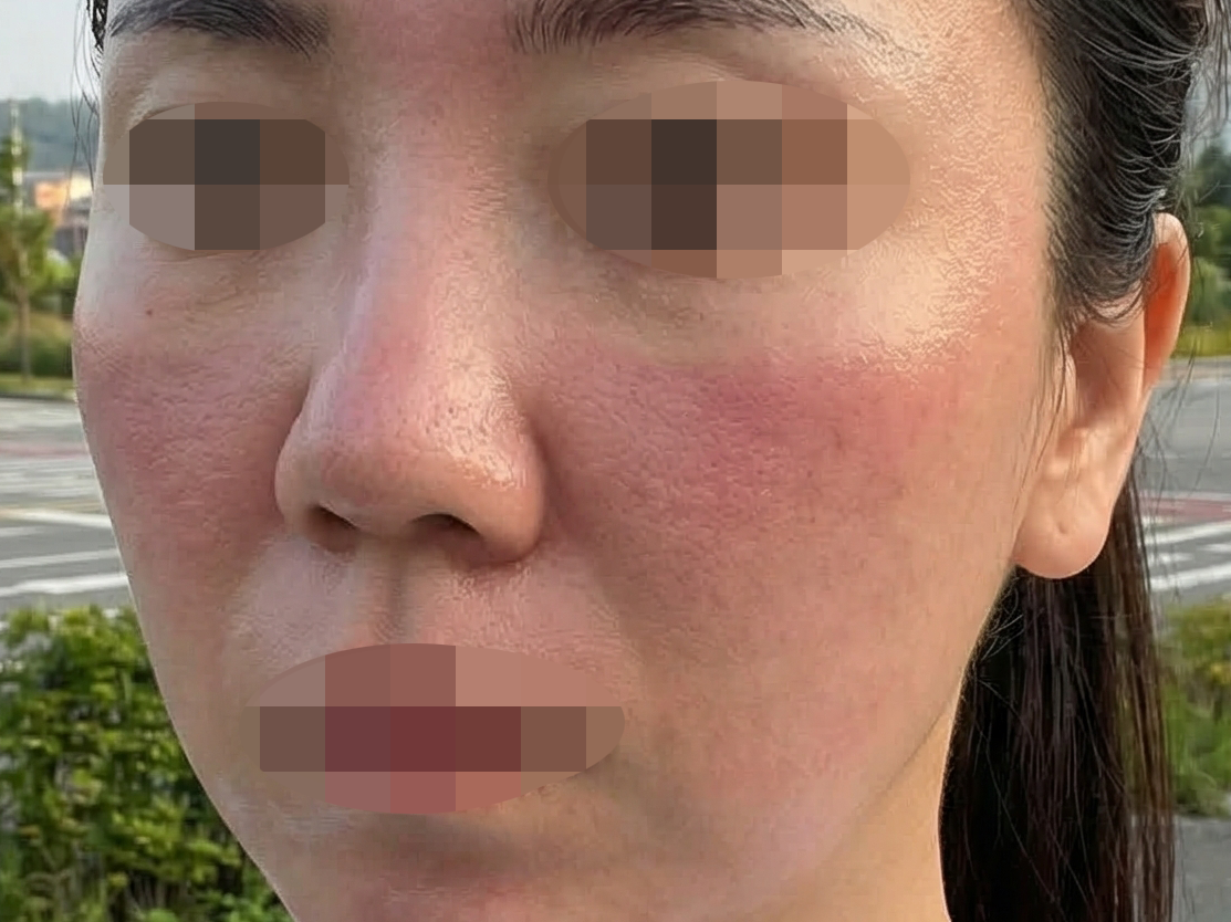 수술후기이미지