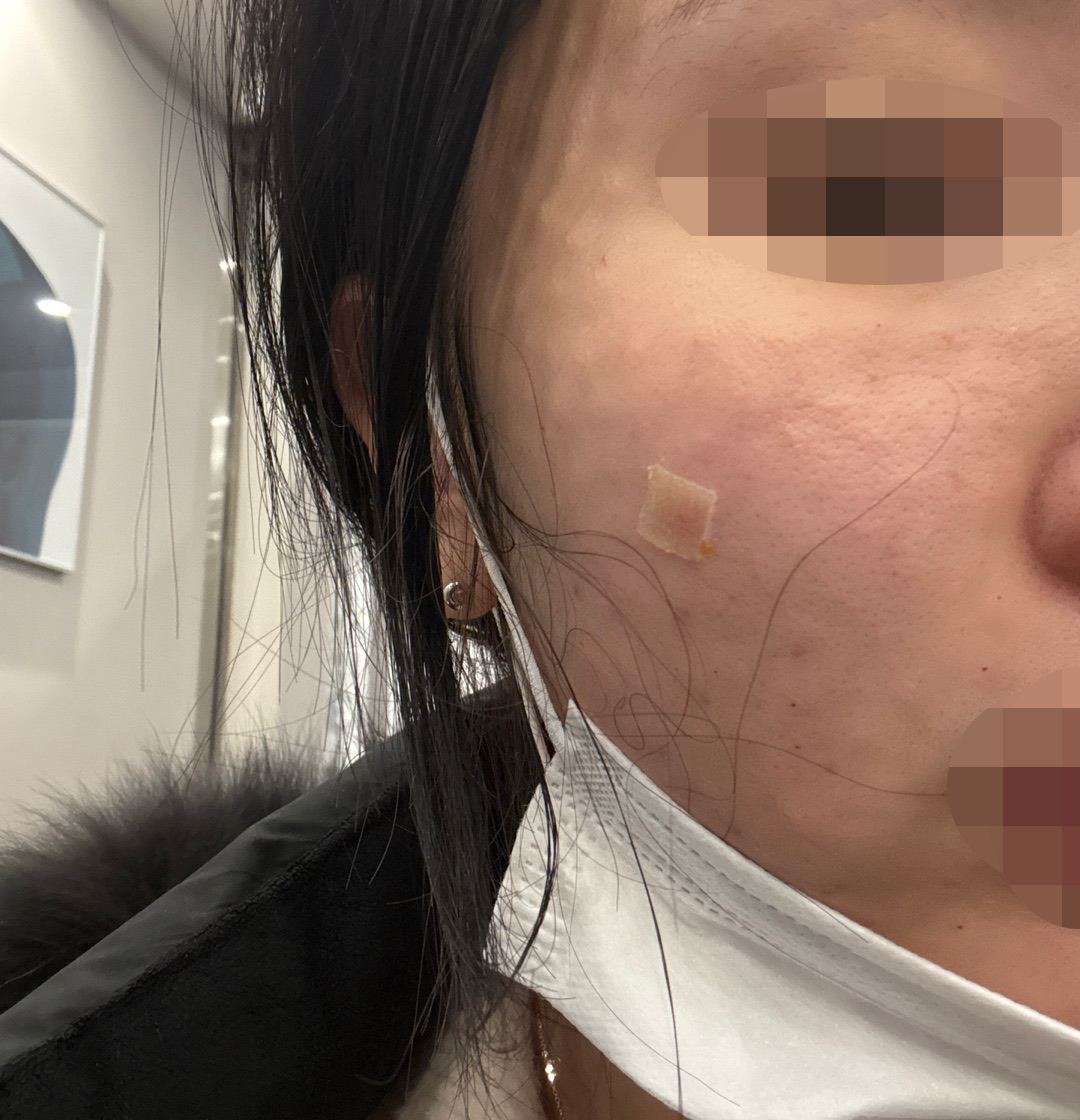 수술후기이미지