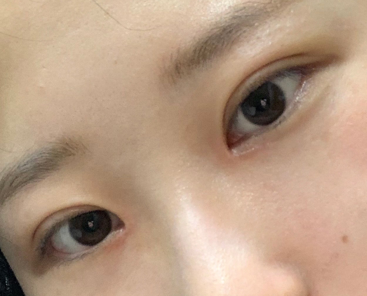 수술후기이미지