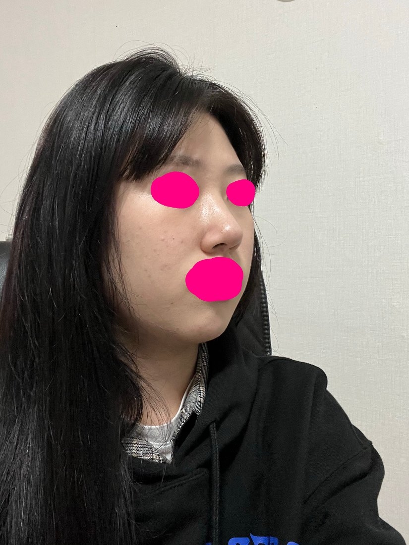 수술후기이미지