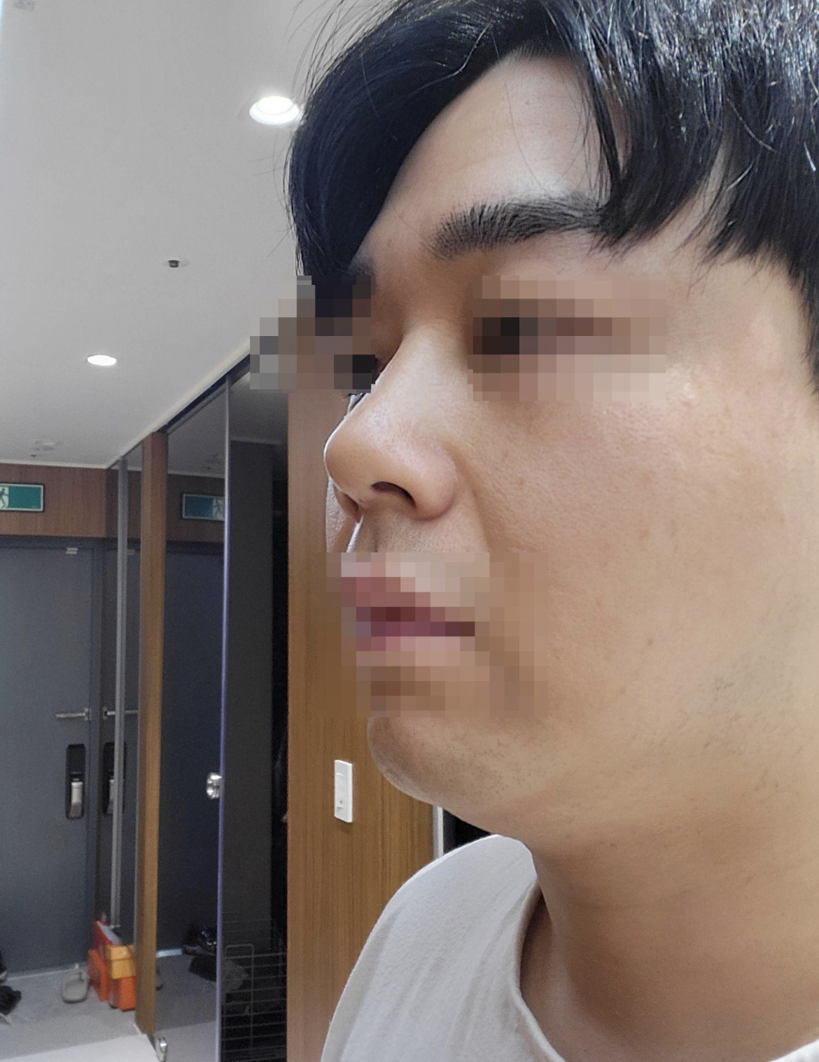 수술후기이미지