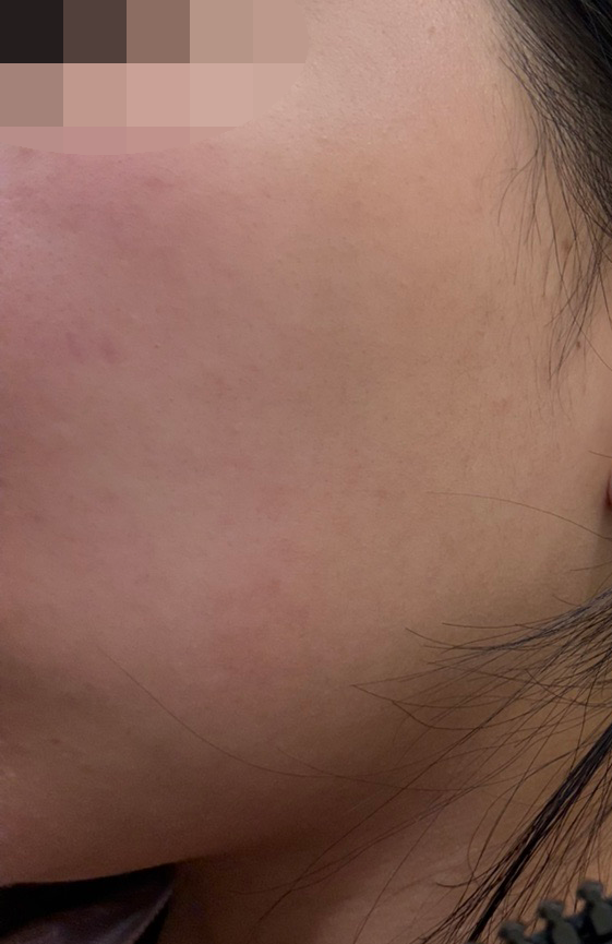 수술후기이미지