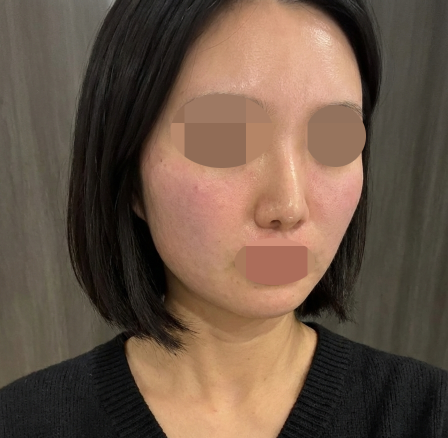 수술후기이미지