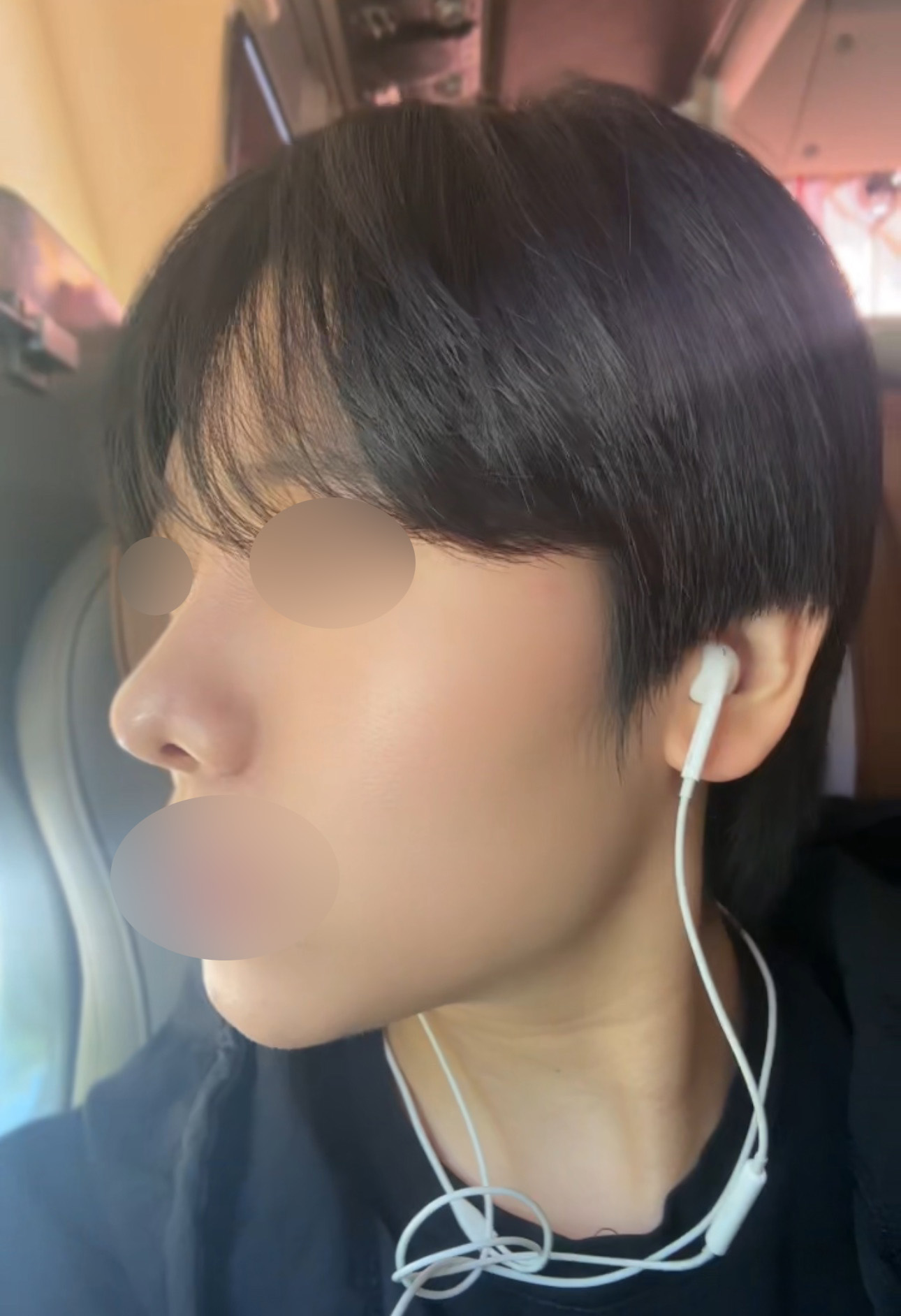 수술후기이미지