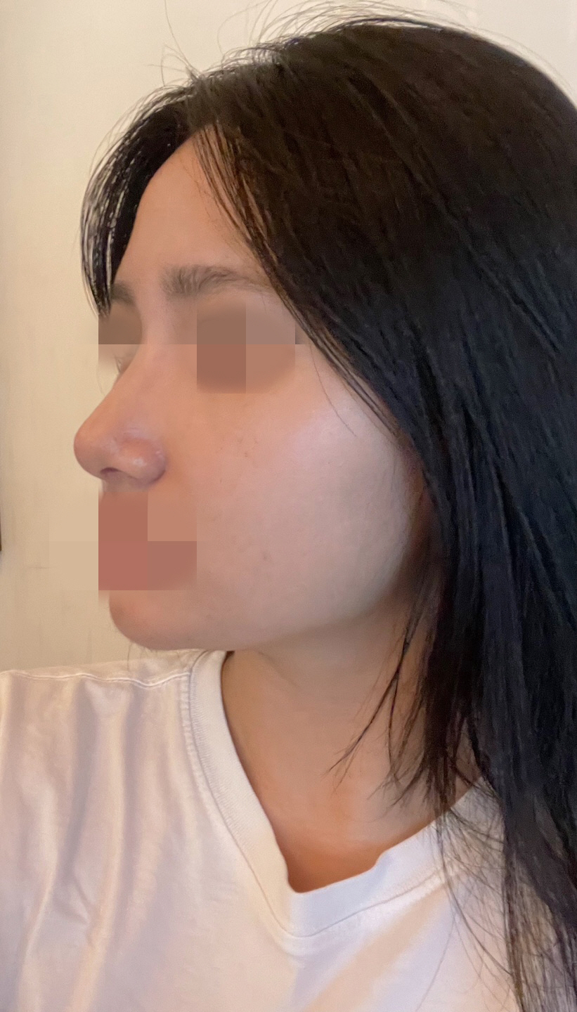 수술후기이미지