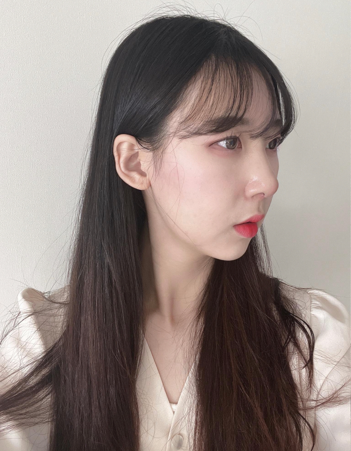 수술후기이미지