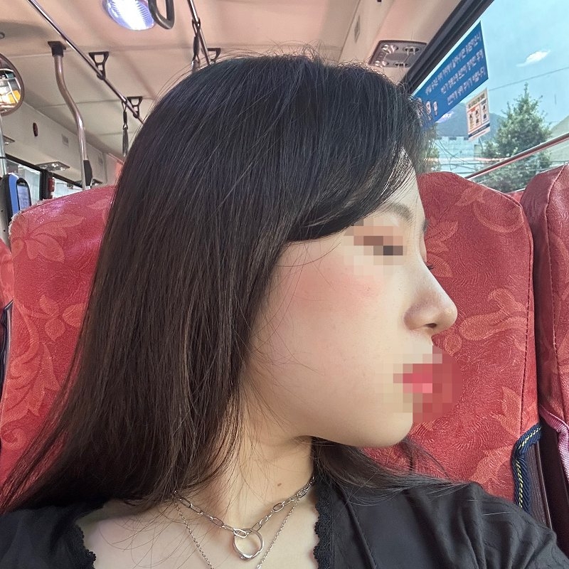 수술후기이미지